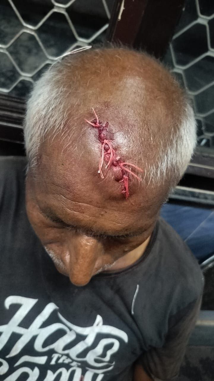 Attack on refusal to smoke ganja, two seriously injured; death threats