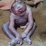 The birth of a strange newborn created a stir in the village, the baby girl died a few hours after birth