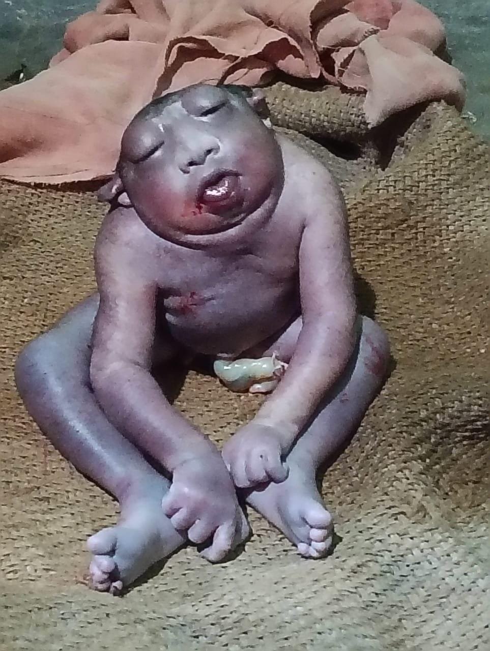 The birth of a strange newborn created a stir in the village, the baby girl died a few hours after birth
